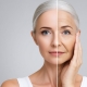 mezoeffect anti aging